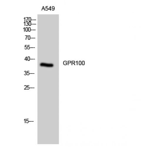 RXFP4 / GPR100 Antibody (300-380 aa, C-terminal)