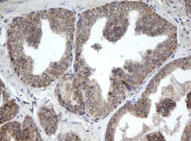 PPT1 / CLN1 Antibody (aa100-306, clone OTI1A10, Carrier-free)