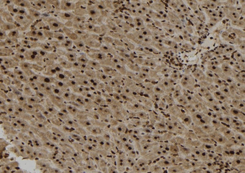 KIAA1840 / SPG11 Antibody