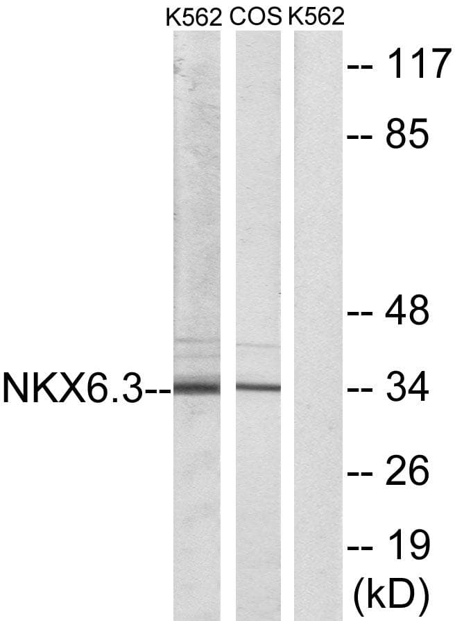 Polyclonal Rabbit anti-Human NKX6-3 Antibody (IF, WB)