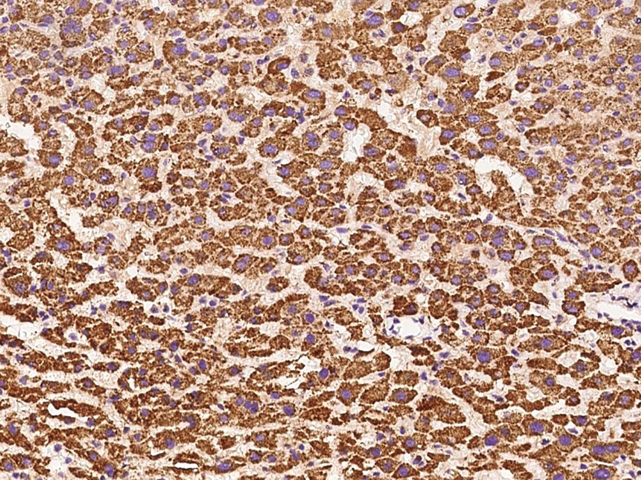GLB1 / Beta-Galactosidase Antibody