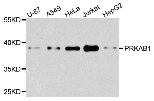 PRKAB1 / AMPK Beta 1 Antibody