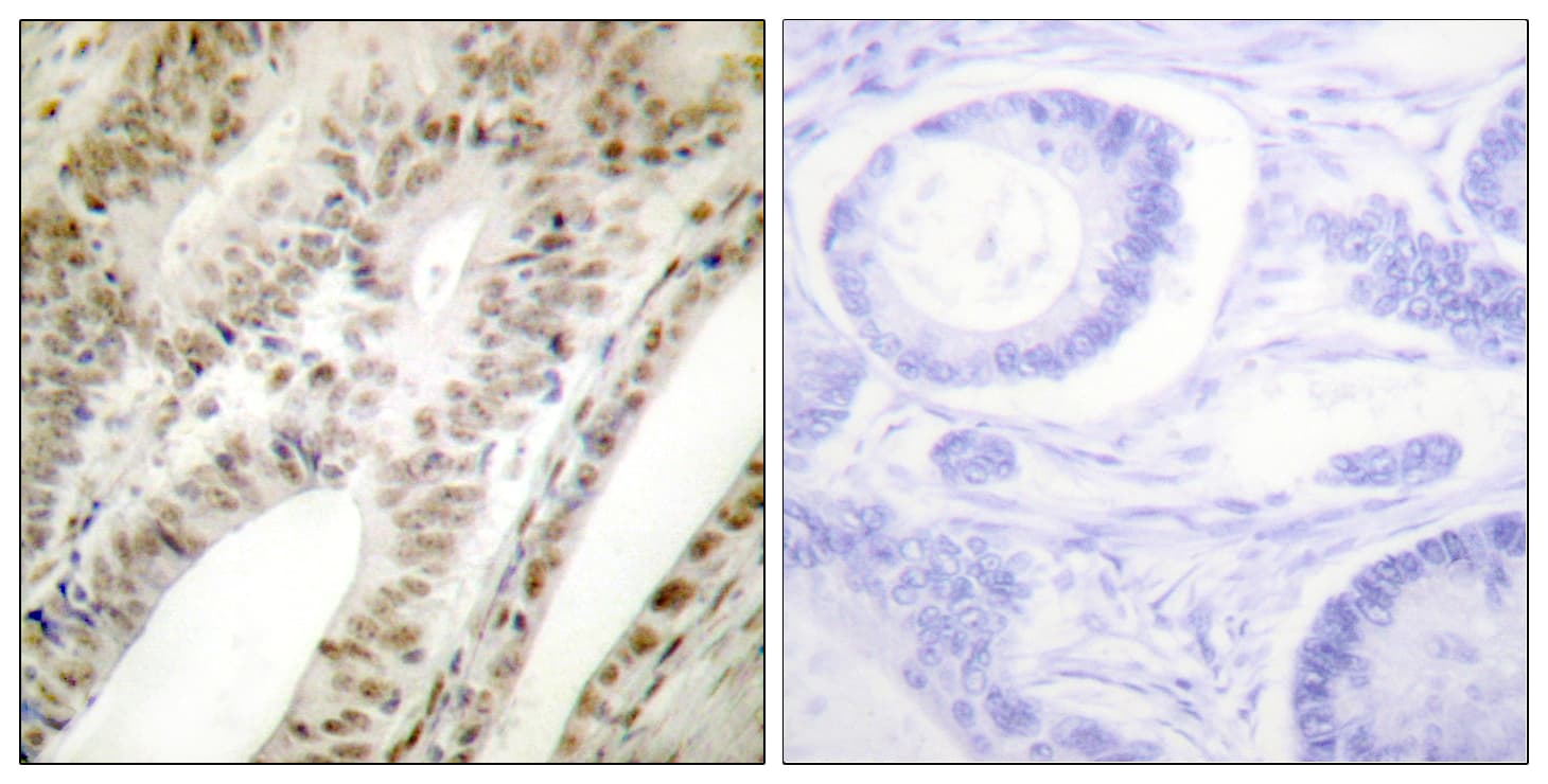 PML Antibody (aa11-60)
