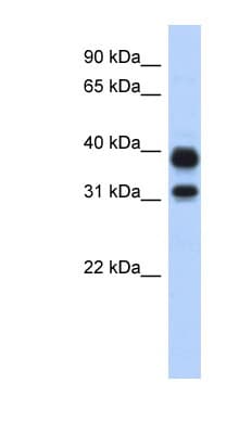 CHIA / Amcase Antibody (N-Terminus)