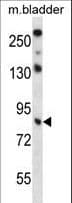 Polyclonal Rabbit anti-Human TRIM36 Antibody (aa310-339, IHC, WB)