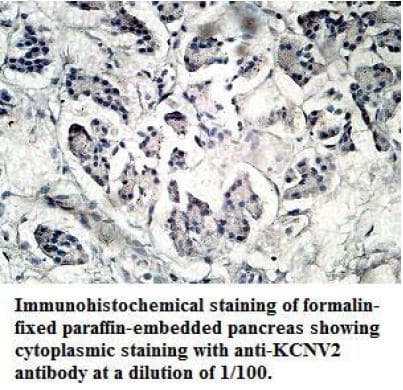 KCNV2 / Kv11.1 Antibody (aa12-154)