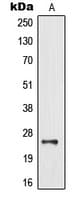 MOBKL2B / MOB3B Antibody (Internal)