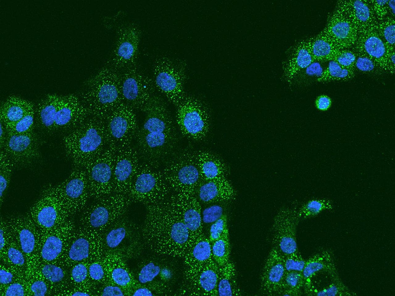 Polyclonal Rabbit anti-Human DLG4 / PSD95 Antibody (IHC, IF)