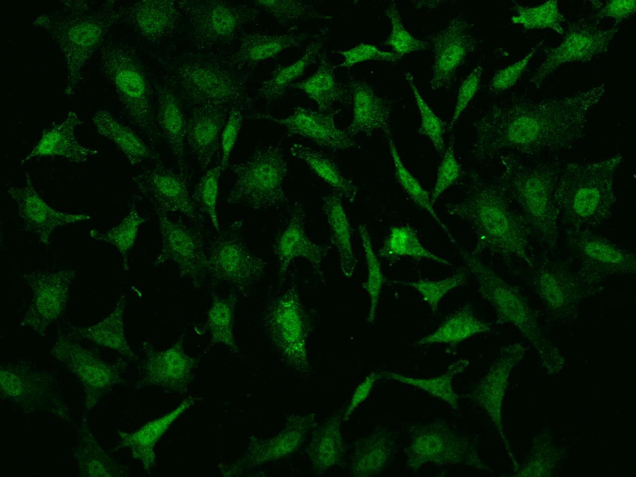 Polyclonal Rabbit anti-Human NR4A2 / NURR1 Antibody (IHC, IF)