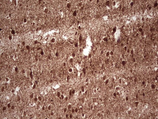 NEFM / NF-M Antibody (aa413-773, clone OTI5B7, Carrier-free)