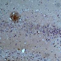 Polyclonal Rabbit anti-Human ASIC1 / ACCN2 Antibody (IHC, WB)