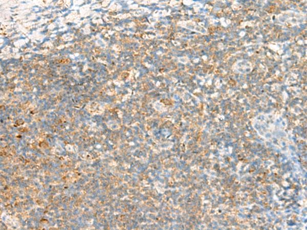 TTLL1 Antibody