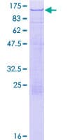 Human TOX4 / C14orf92 Protein (Recombinant GST)
