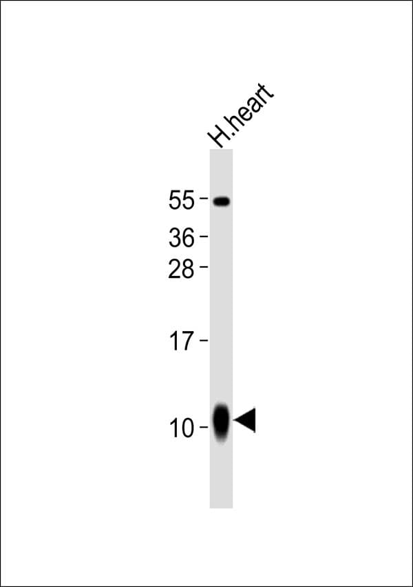 S100A1 / S100-A1 Antibody