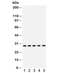 Polyclonal Rabbit anti-Human XBP1 Antibody (aa55-89, IHC, WB)