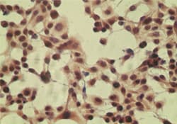 Polyclonal Rabbit anti-Human CYLD Antibody (aa32-45, WB)