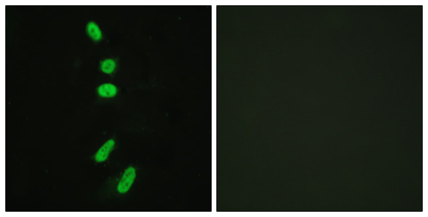 IHC-plus™ SF1 Antibody (aa48-97)