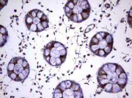 CD30 Antibody (clone OTI16H5)