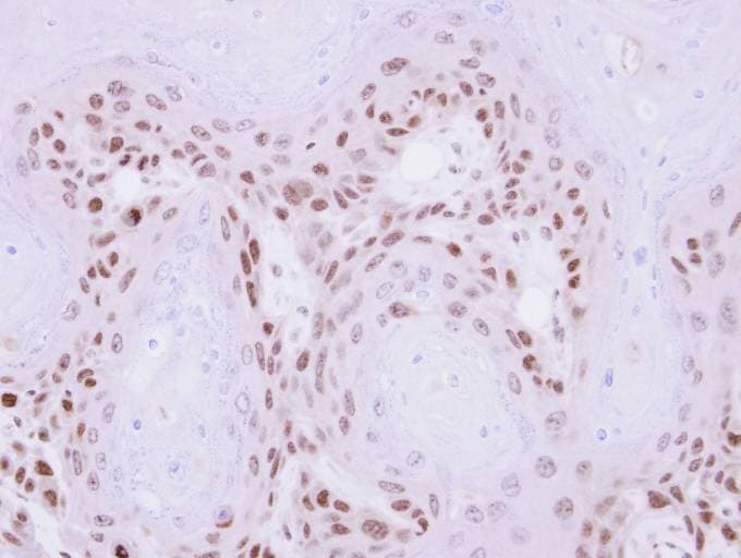 MAGEA11 Antibody (aa78-173)