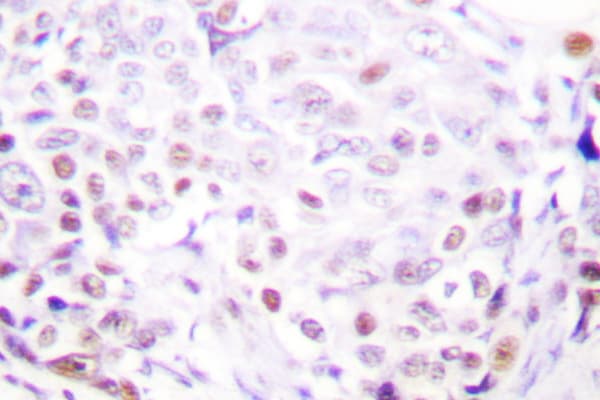 Polyclonal Rabbit anti-Human SENP3 Antibody (Tyr24, IHC, WB)