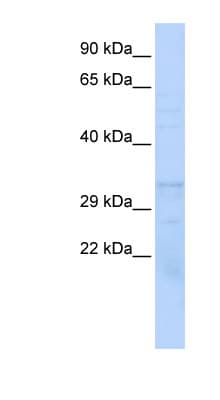PSMB1 Antibody (aa107-156)