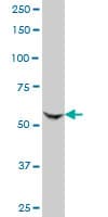 KAT2A / GCN5 Antibody (clone 3F8)