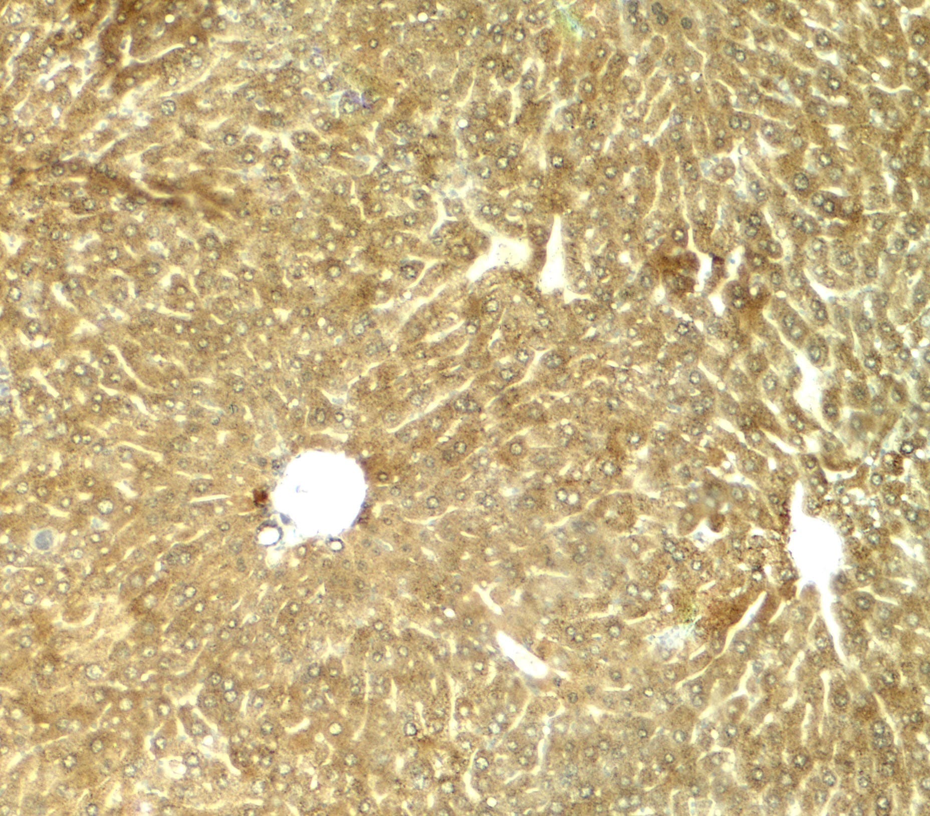 IHC-plus™ TRB3 / TRIB3 Antibody
