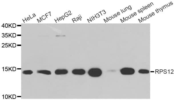 Polyclonal Rabbit anti-Human RPS12 / Ribosomal Protein S12 Antibody (IHC, IF, WB)