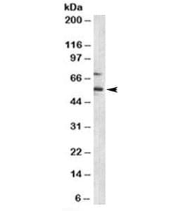 Monoclonal Mouse anti-Human CDKN1C / p57 Kip2 Antibody (clone KP10, IHC, IF, WB)