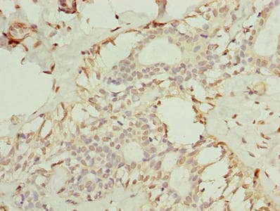 Polyclonal Rabbit anti-Human TMEM154 Antibody (IHC, WB)