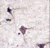 PTPRR Antibody (aa234-265)