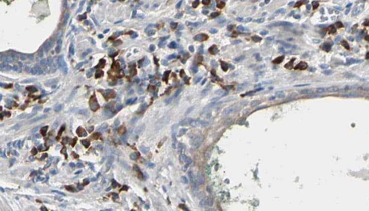 Polyclonal Rabbit anti-Human HMT / HNMT Antibody (IHC, IF, WB)