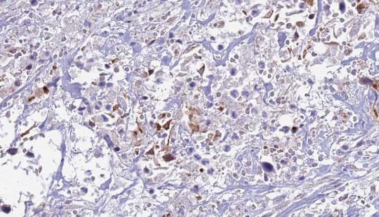 S100A12 Antibody