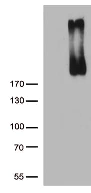 ERBB3 / HER3 Antibody (clone OTI1F1)