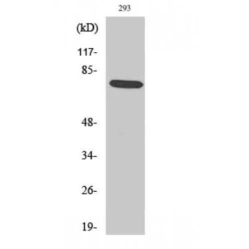 LIMK1 / LIMK Antibody (440-520 aa)