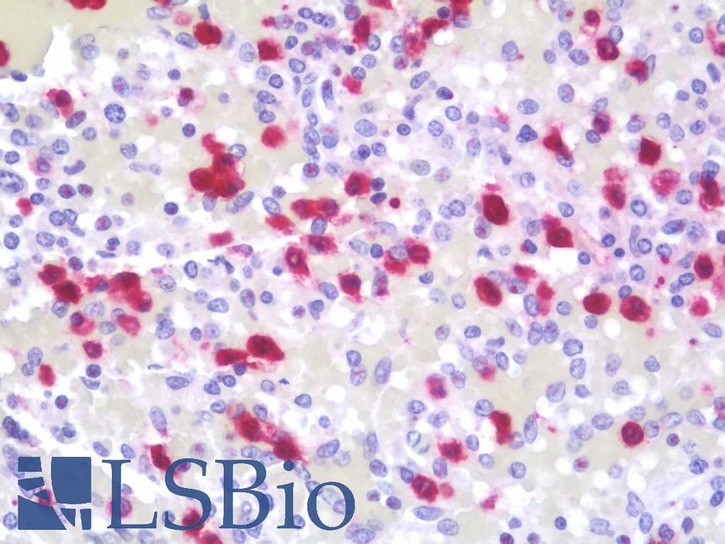 IHC-plus™ Polyclonal Rabbit anti-Human HNP-4 / DEFA4 Antibody (Asp27, IHC, WB)
