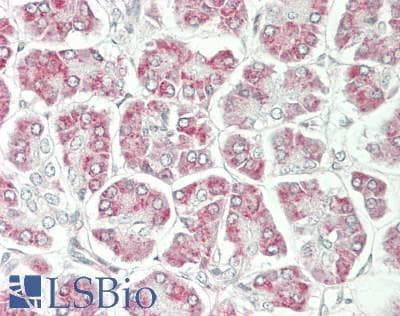 IHC-plus™ Polyclonal Rabbit anti-Human AIMP1 / EMAP II Antibody (IHC, IF, WB)