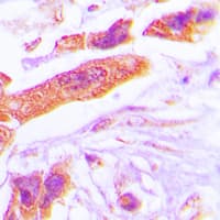 Polyclonal Rabbit anti-Human PSMD6 Antibody (Internal, IHC, WB)