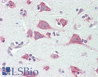 IHC-plus™ EXOG / ENDOGL1 Antibody
