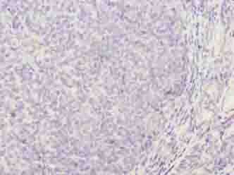 Polyclonal Rabbit anti-Human TRAT1 / TRIM Antibody (IHC)