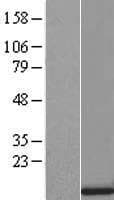 SRP9 Protein (Over-Expression Lysate Myc-DDK (Flag))