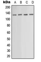 IHC-plus™ Polyclonal Rabbit anti-Human PKN1 Antibody (aa246-285, IHC, IF, WB)