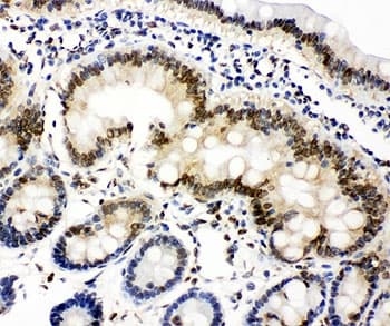 LMNA / Lamin A+C Antibody (aa455-469)