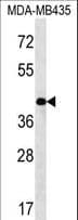 SERPINE2 / Nexin Antibody (aa106-135)