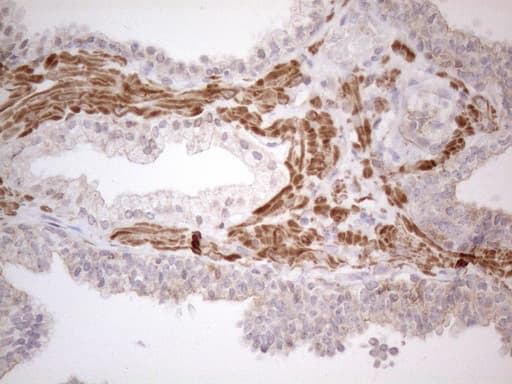 ATF1 Antibody (clone OTI7H3, Carrier-free)