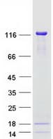 Human DAXX Protein (Recombinant Myc-DDK (Flag))