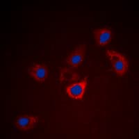 BCL2 / Bcl-2 Antibody (Internal)