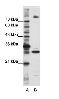 Polyclonal Rabbit anti-Human SRSF10 / FUSIP1 Antibody (C-Terminus, IHC, WB)