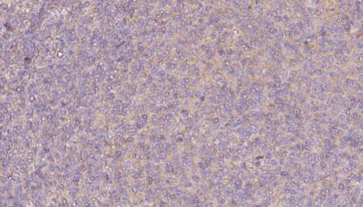 PRPH2 Antibody