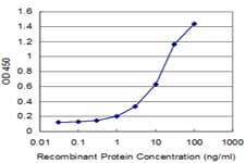 Monoclonal Mouse anti-Human FBP / FOLR2 Antibody (clone 4B12, WB)